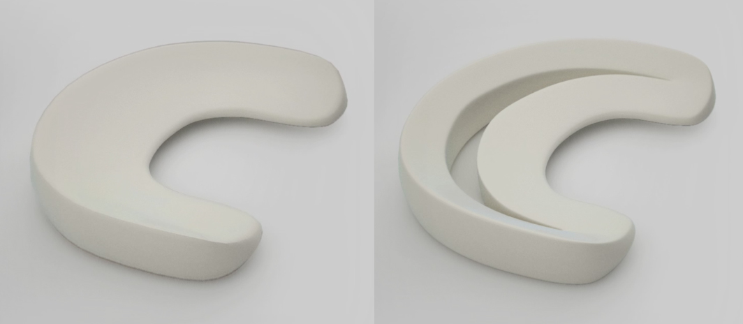 MENISQUE 3D FISSURE DECHIRURE MENISQUE CHIRURGIE DU SPORT